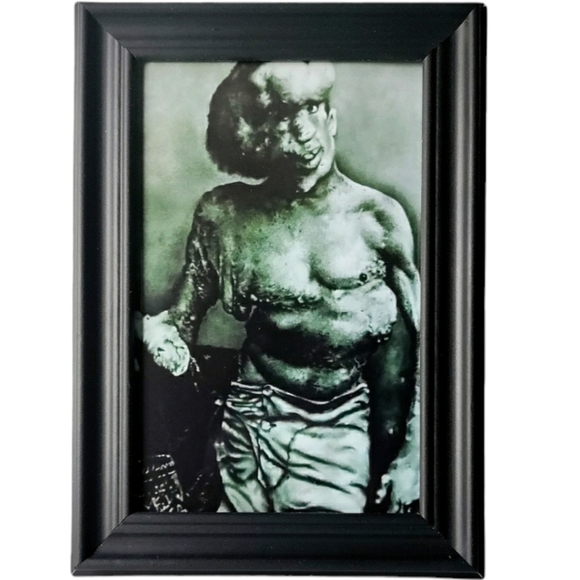 elephant man john merrick Freakshow Sideshow Carnival Circus Oddity Framed Photo - Picture 1 of 3